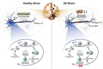 The emerging role of autophagy and mitophagy in tauopathies: From pathogenesis to translational implications in Alzheimer’s disease